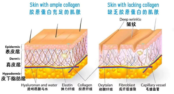 胶原蛋白,补充胶原蛋白,胶原蛋白肽